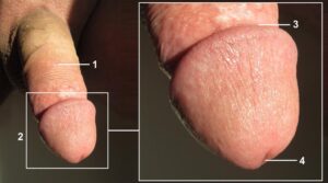 Najlepszy rozmiar penisa – jak dopasować go do swoich potrzeb?