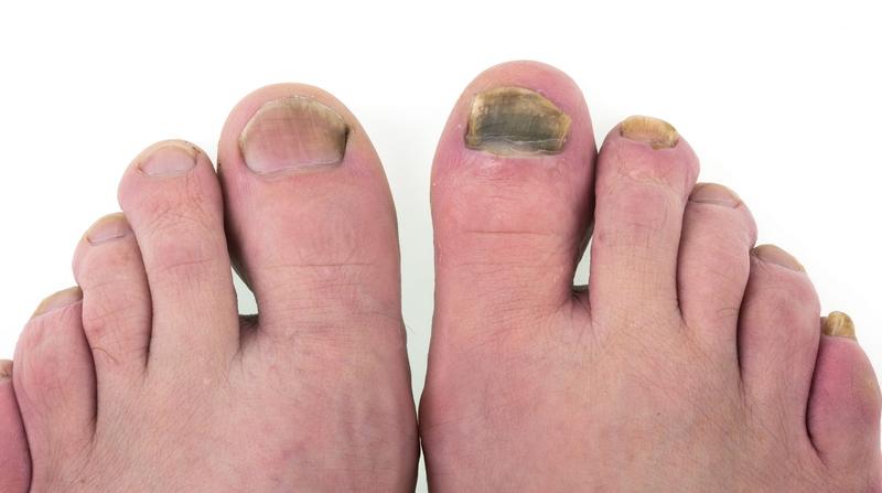 Zdrowie paznokci i manicure