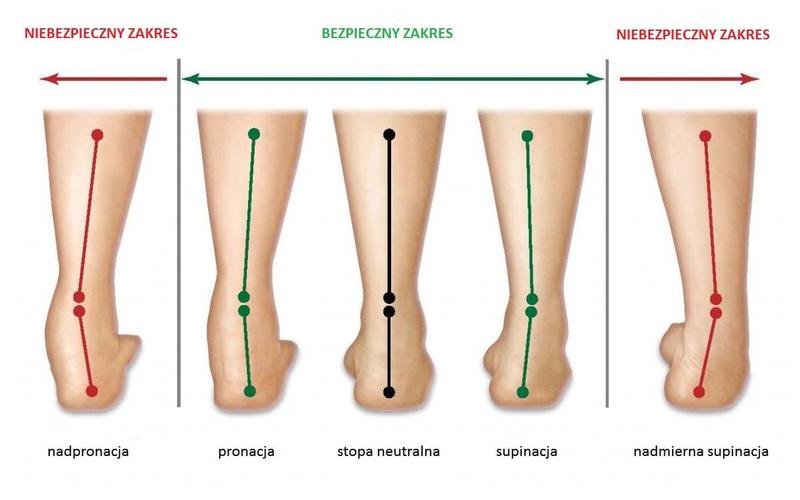 Jakie buty wybierać dla supinatora? Poradnik dla zdrowych stóp